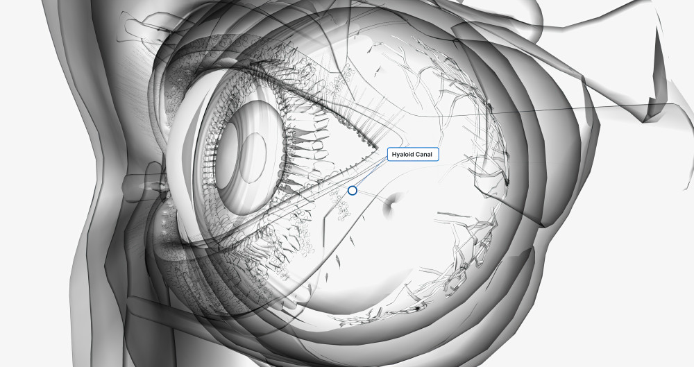 백내장 수술비용