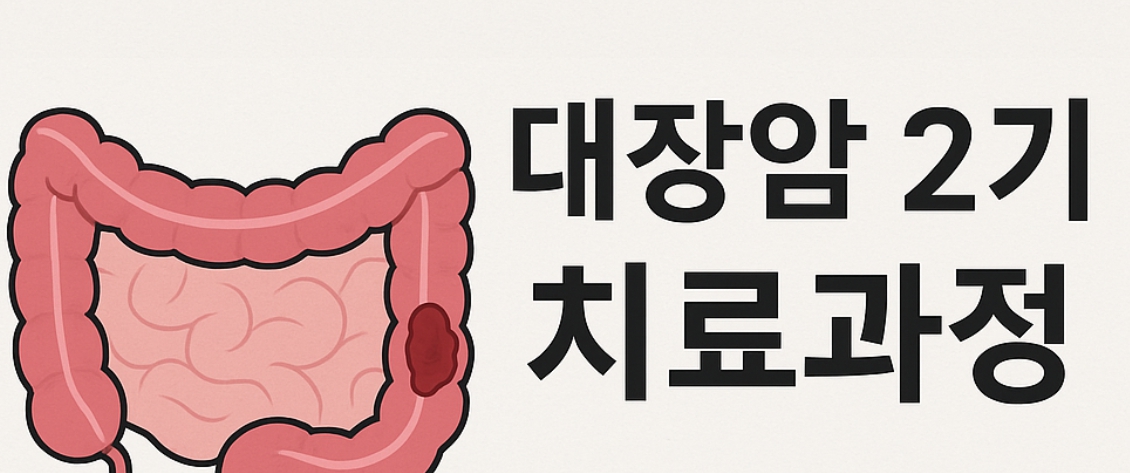 대장암 2기 치료과정