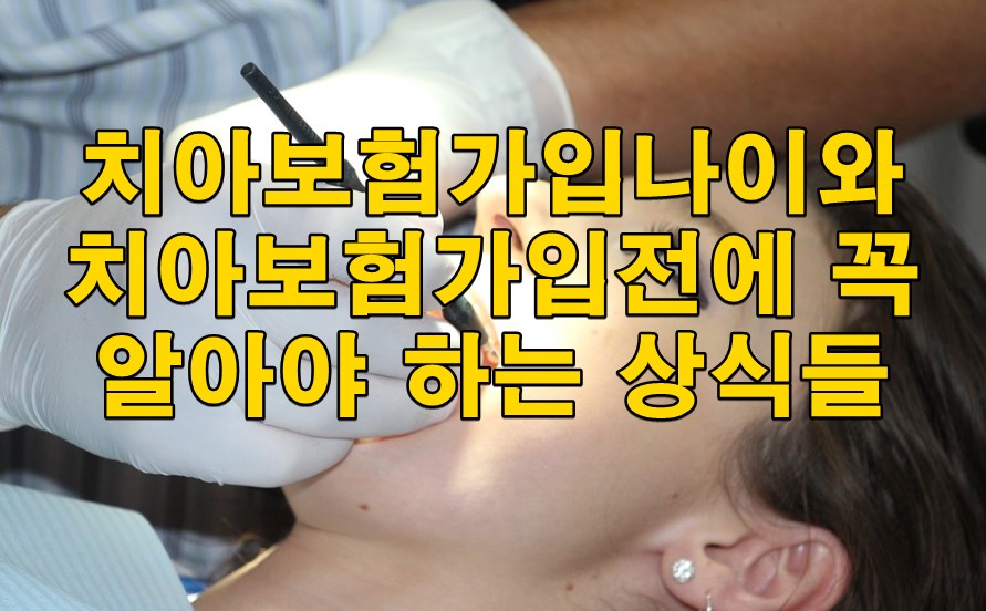 치아보험가입나이와 치아보험가입전에 꼭 알아야 하는 상식들 사진 1