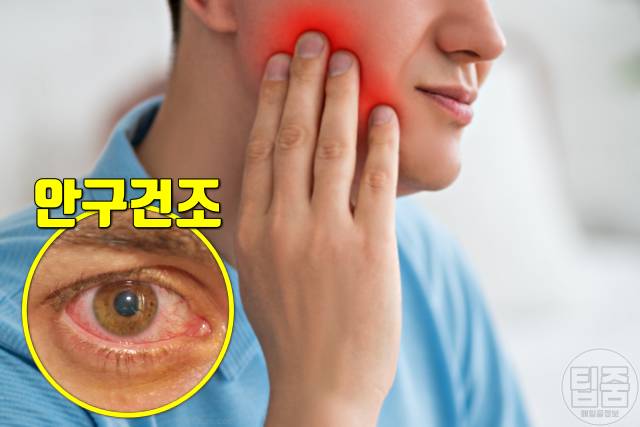 귀밑 턱 부음 원인 쇼그렌증후군 귀밑 턱이 부었어요