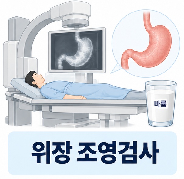 위장 조영검사에서 바륨과 X선 투시 장비로 위를 촬영하는 모습을 보여주는 안내 이미지