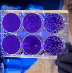 대상포진 초기증상 원인 예방 관리법