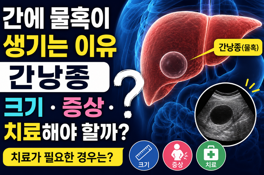 간 물혹은 암일까? 간낭종 크기와 증상, 치료가 필요한 때