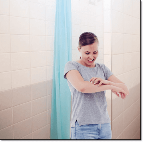 피부염으로 팔이 가려운 여성