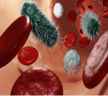 비브리오패혈증이란