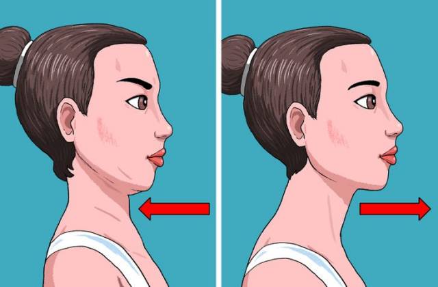 윤곽주사 턱선 살리기 운동 턱선리프팅 마사지 쇄골