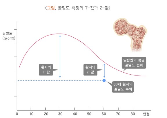 연령별 골밀도 측정 그래프