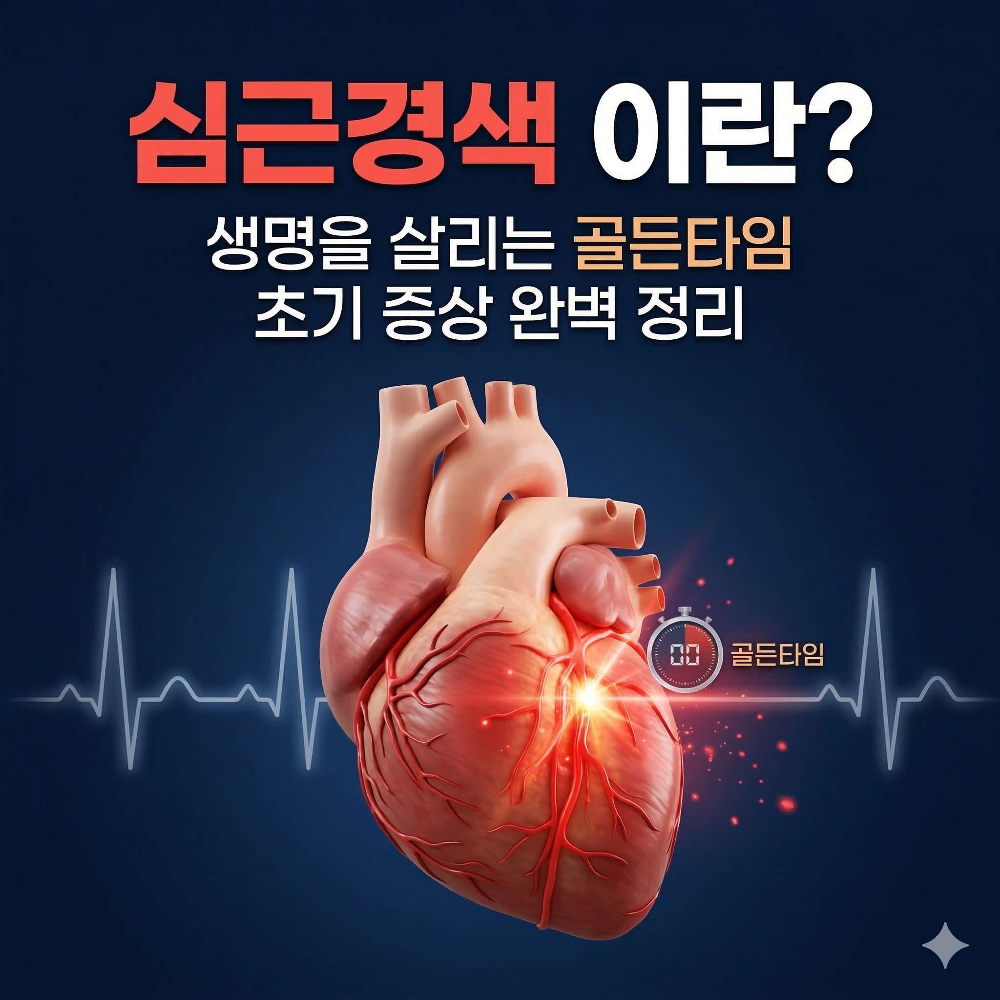 심근경색 이란? 생명을 살리는 골든타임과 초기 증상 완벽 정리