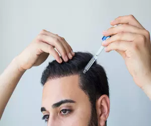 두피 가려움증 원인