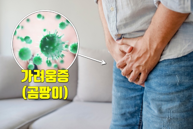 사타구니 가려움증 백선 따가움, 건강 팁줌 매일꿀정보