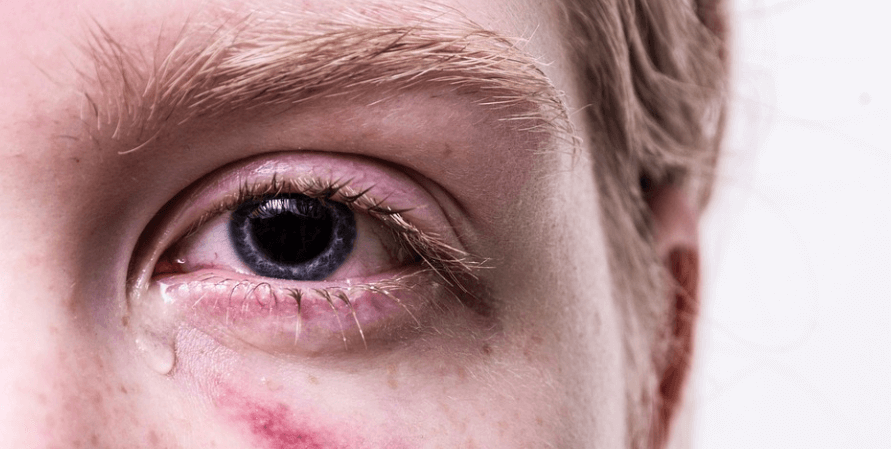 눈물이 자주 자는 이유로 눈물을 흘리고 있는 남자