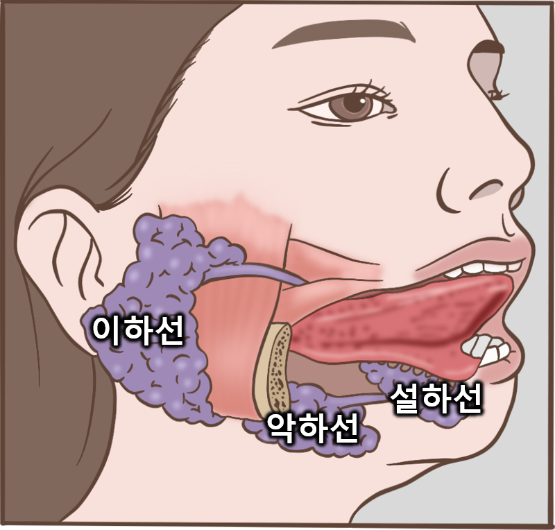 침샘염 증상과 침샘염 치료, 구강내과의사가 다 알려드림