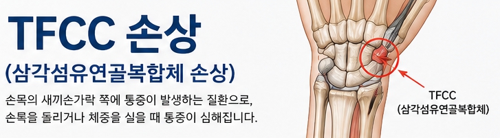 손목 골절