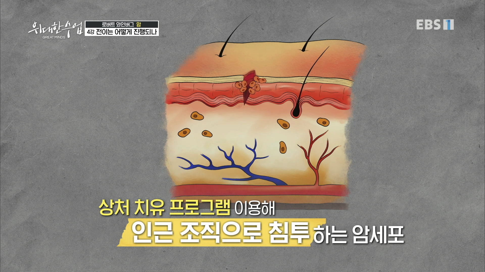 상처 치유 프로그램