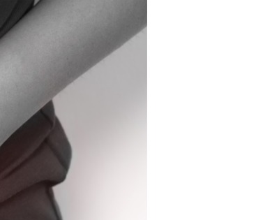 맹장염 초기증상