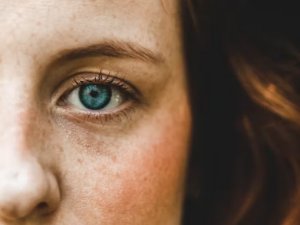 비립종 생기는 이유