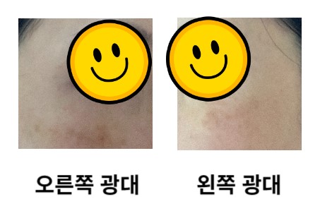 얼굴사진before