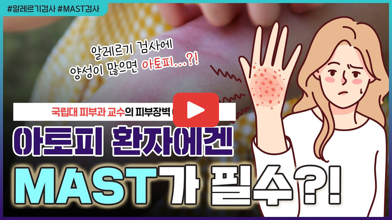 알레르기검사 비용과 종류 비염 두드러기 해결법