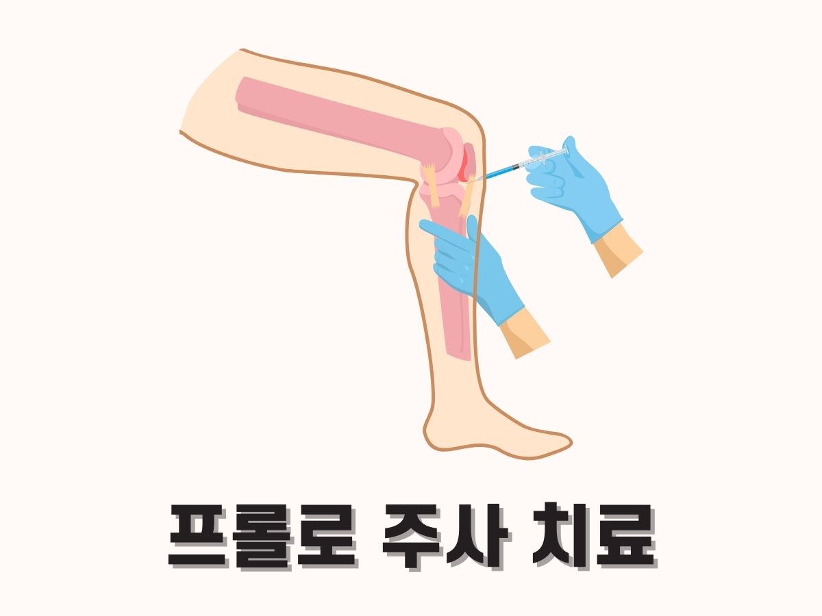프롤로주사 치료란 (가격, 부작용, 회복기간, 실비)