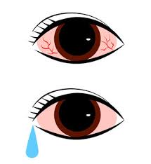 눈이 충혈되는 이유