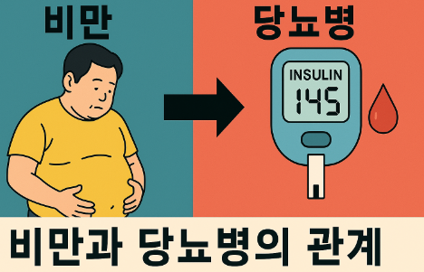 비만과 당뇨병의 관계 관련 사진