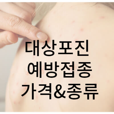대상포진 예방접종 가격 썸네일