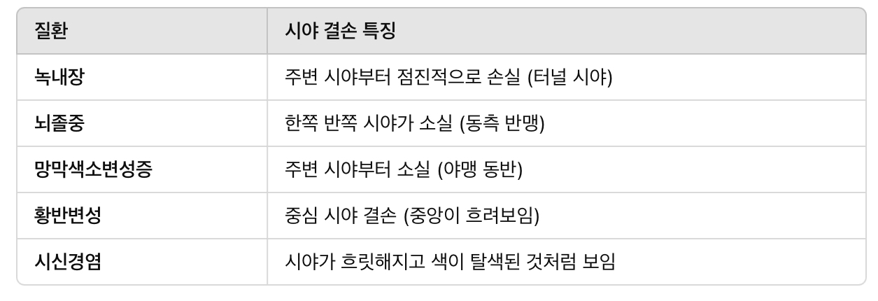 이상 시야 패턴 (질환별 특징적 패턴)