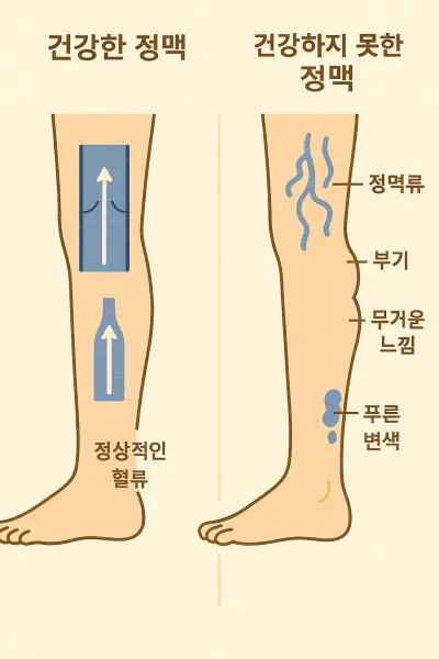 건강한 정맥