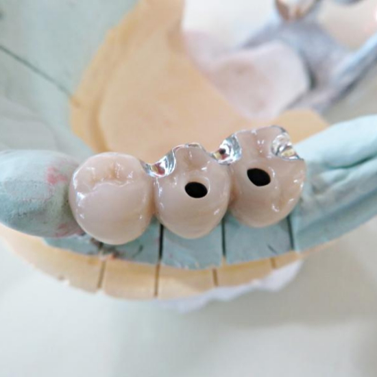 임플란트 시술 전후 주의사항1