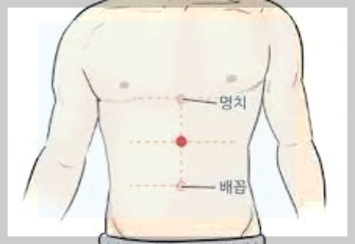명치 위치
