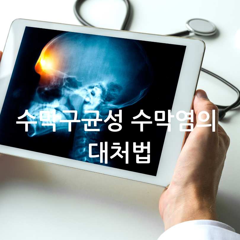 수막구균성 수막염 증상, 원인, 대처법