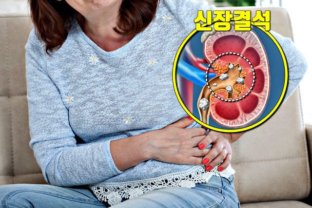 왼쪽 옆구리 통증 의심되는병 신장결석 증상,건강 팁줌 매일꿀정보
