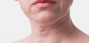 목부터 생기는 주름, 이렇게 관리해 보자.