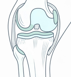 무릎 안쪽 통증 원인
