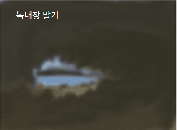 녹내장 증상 - 녹내장 말기 시력