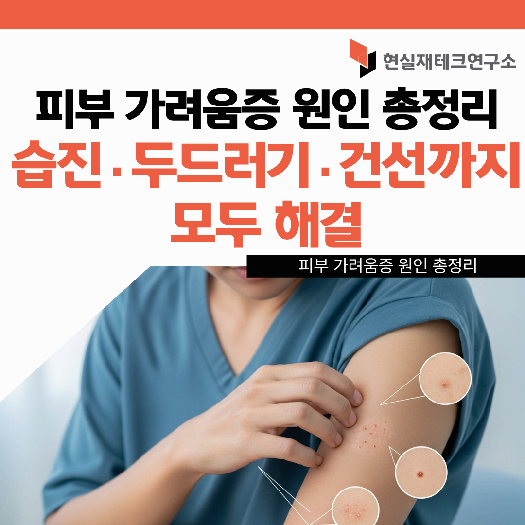 피부 가려움