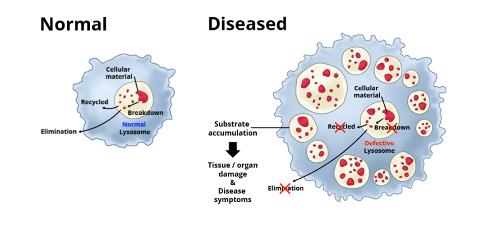 리소좀이 정상일때와 비정상 상태일 때의 내부 구조