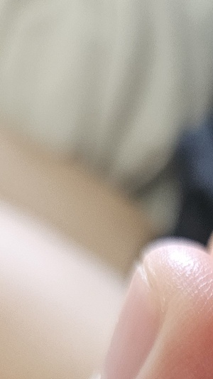 수족구병 증상 격리기간