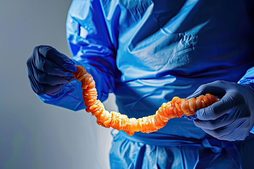 대장암 초기증상