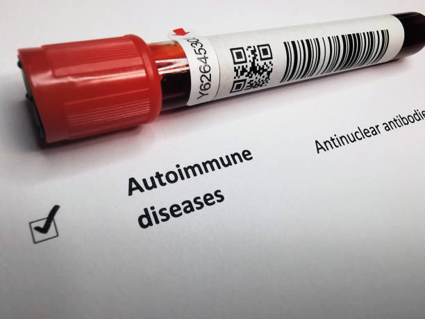 자가면역질환 혈소판 이상