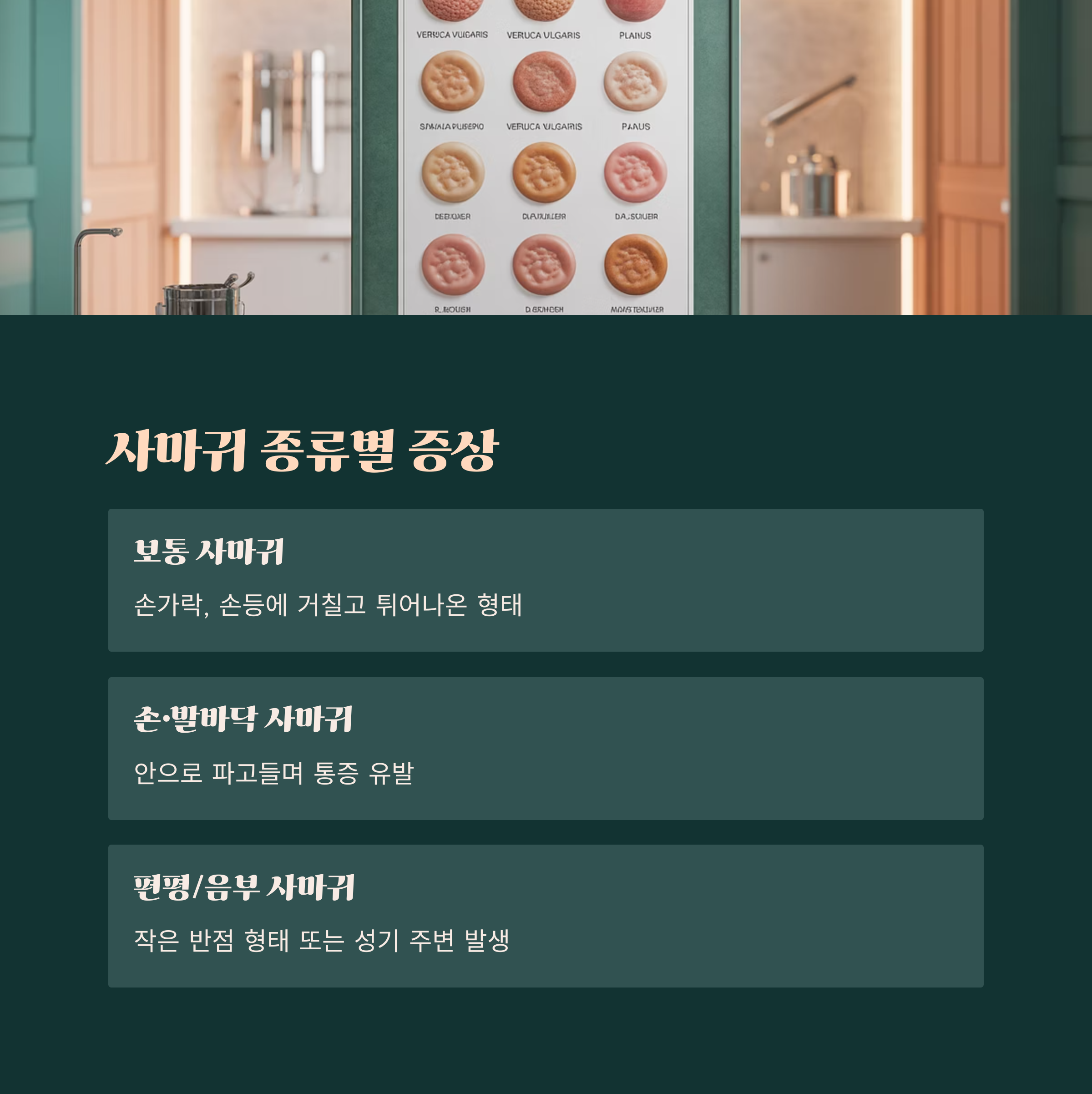 여러 종류의 사마귀 샘플 이미지가 벽에 진열되어 있고, 하단에는 보통 사마귀, 손발바닥 사마귀, 편평·음부 사마귀의 증상을 구분해 소개하는 설명 이미지