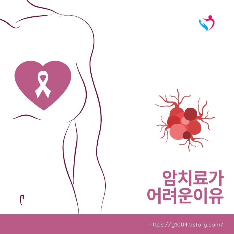 암 치료가 어려운 이유