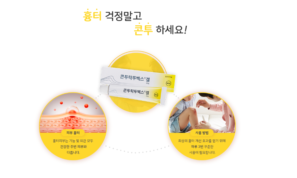 콘투락투벡스 여드름 연고