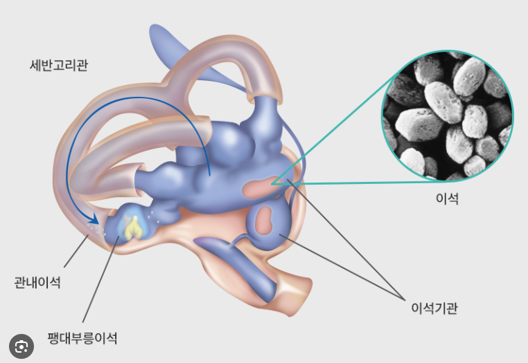 이석증 증상과 자가치료법
