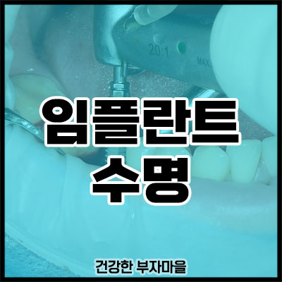임플란트 수명