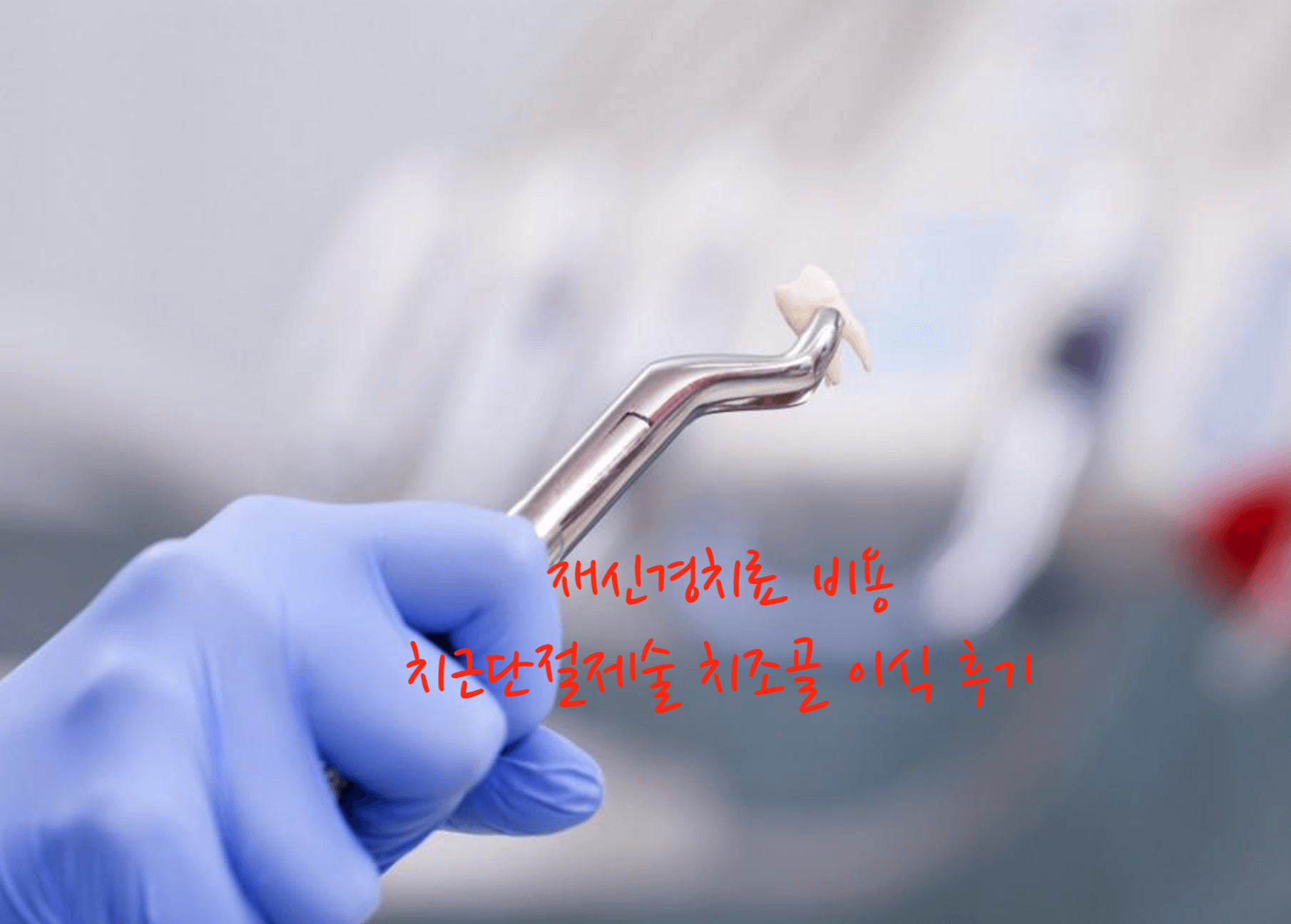 재신경치료