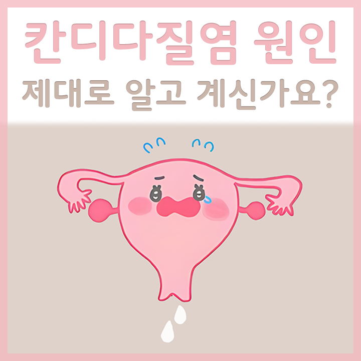 칸디다질염이-발생한-자궁의-모습