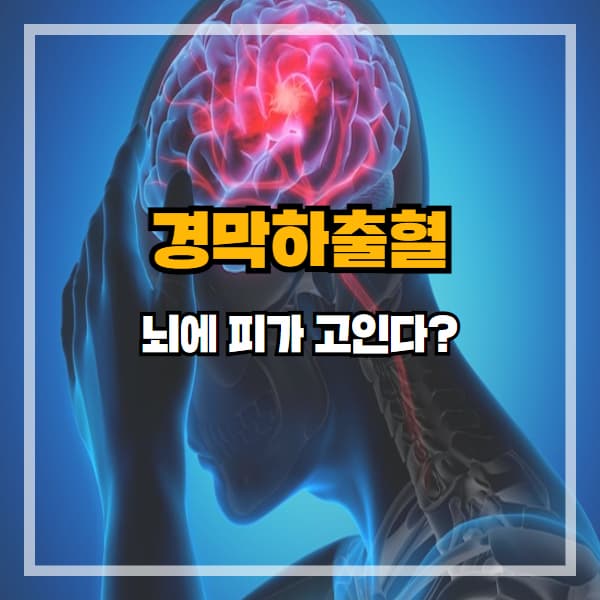 뇌에 피가 고인다? 경막하출혈 초기 증상 꼭 확인하세요
