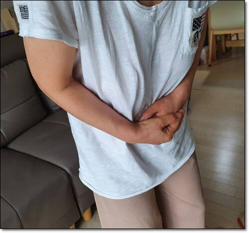 위염 환자