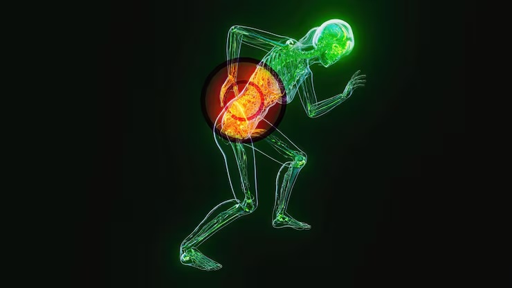 고관절 통증 증상